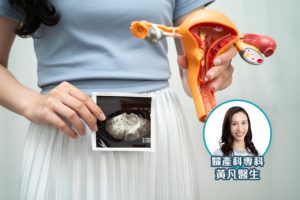 染发剂沾到皮肤怎么处理？及时清洁比事后用力擦更重要